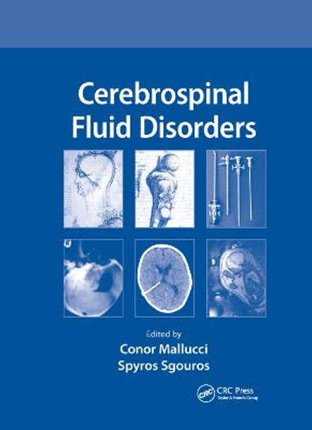 Cerebrospinal Fluid Disorders by Conor Mallucci