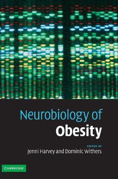 Neurobiology of Obesity by Jenni Harvey