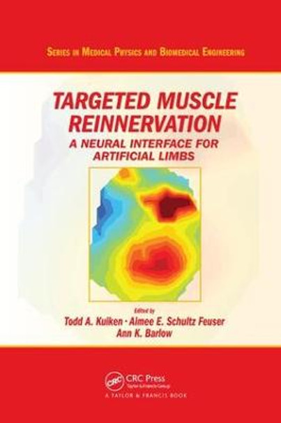 Targeted Muscle Reinnervation: A Neural Interface for Artificial Limbs by Todd A. Kuiken