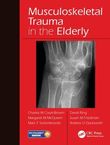 Musculoskeletal Trauma in the Elderly by Charles Court-Brown