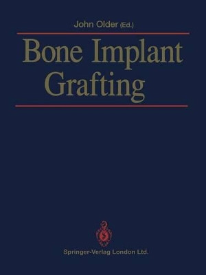 Bone Implant Grafting by John Older 9781447119364