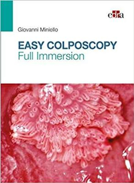 Easy Colposcopy. Full Immersion by Giovanni Miniello