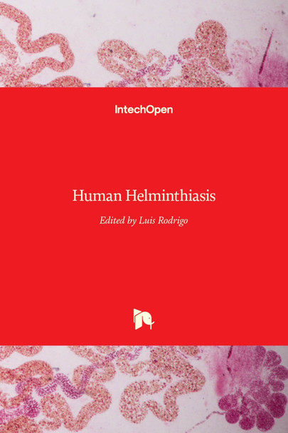Human Helminthiasis by Luis Rodrigo 9789535129530