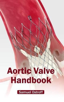 Aortic Valve Handbook by Samuel Ostroff 9781632410481