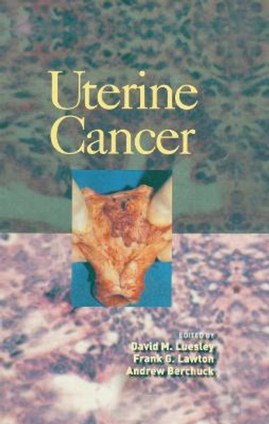 Uterine Cancer by David M. Luesley