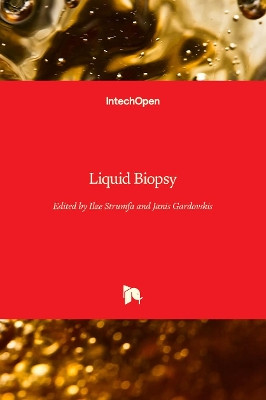 Liquid Biopsy by Ilze Strumfa 9781838811297