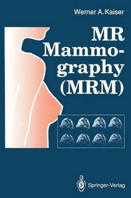 MR Mammography (MRM) by Werner A. Kaiser 9783642772580