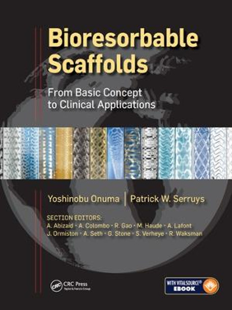 Bioresorbable Scaffolds: From Basic Concept to Clinical Applications by Yoshinobu Onuma