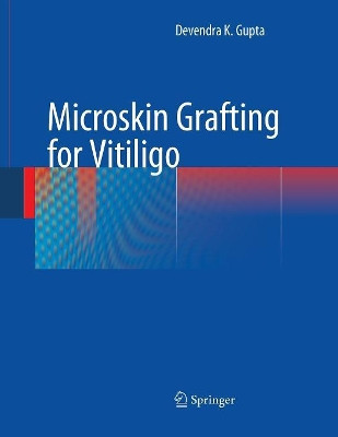 Microskin Grafting for Vitiligo by Devendra K. Gupta 9781447168799