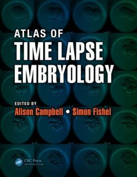 Atlas of Time Lapse Embryology by Alison Campbell