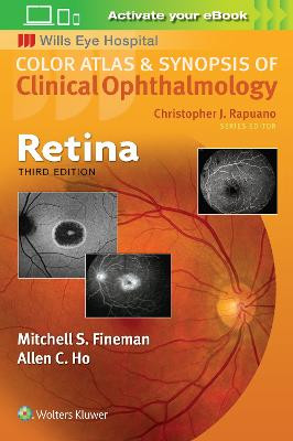 Retina by Mitchell Fineman