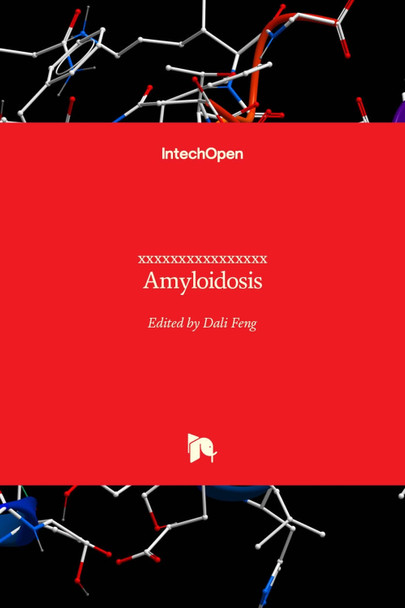 Amyloidosis by Dali Feng 9789535111009