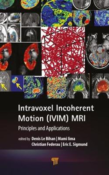 Intravoxel Incoherent Motion (IVIM) MRI: Principles and Applications by Denis Le Bihan