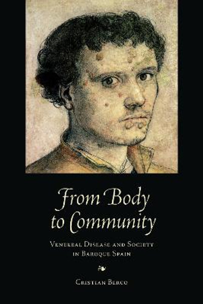 From Body to Community: Venereal Disease and Society in Baroque Spain by Cristian Berco