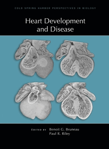 Heart Development and Disease by Benoit Bruneau 9781621823582