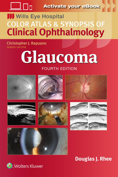 Glaucoma by Douglas J. Rhee 9781975214814