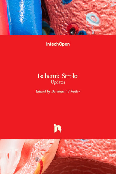Ischemic Stroke: Updates by Bernhard Schaller 9789535127123