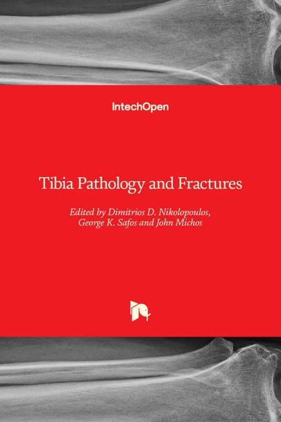 Tibia Pathology and Fractures by Dimitrios D. Nikolopoulos 9781839624063