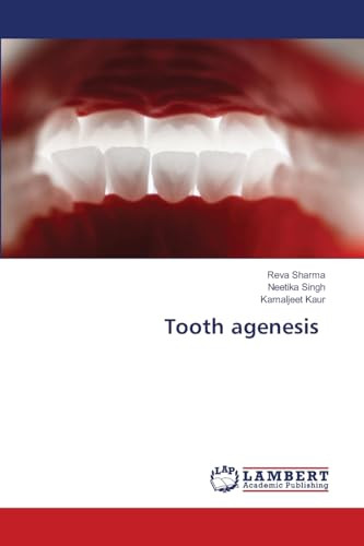 Tooth agenesis by Reva Sharma 9786207653430