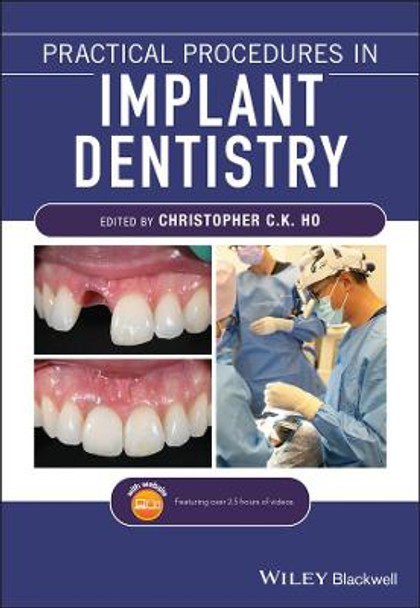 Practical Procedures in Implant Dentistry by Christopher C. K. Ho