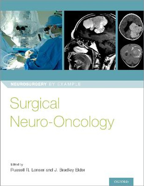 Surgical Neuro-Oncology by Russell R. Lonser