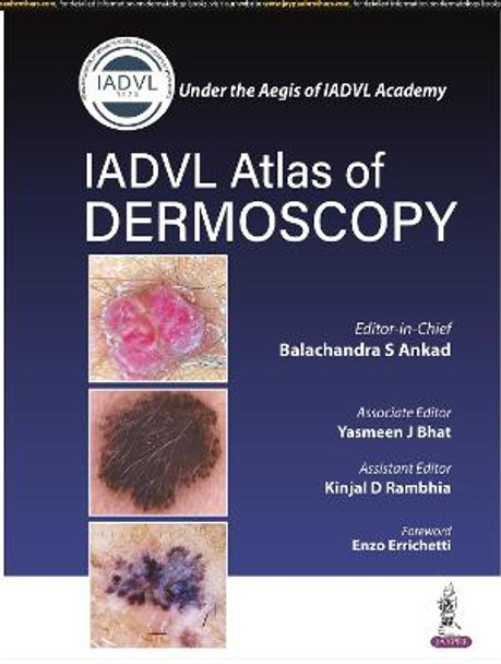 Atlas of Dermoscopy by Balachandra S Ankad