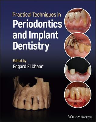 Practical Techniques in Periodontics and Implant Dentistry Edgard El Chaar 9781119793557
