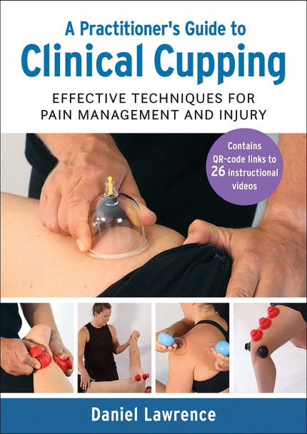 A Practitioner's Guide to Clinical Cupping: Effective Techniques for Pain Management and Injury by Daniel Lawrence