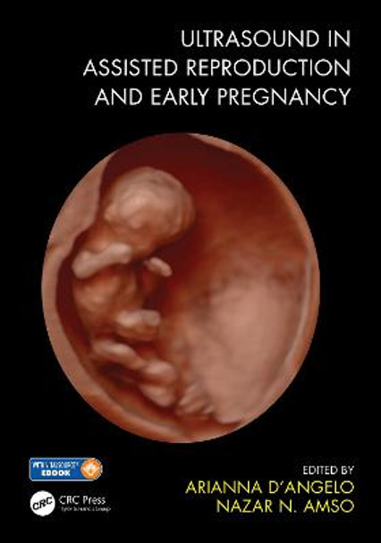 Ultrasound in Assisted Reproduction and Early Pregnancy by Arianna D'Angelo