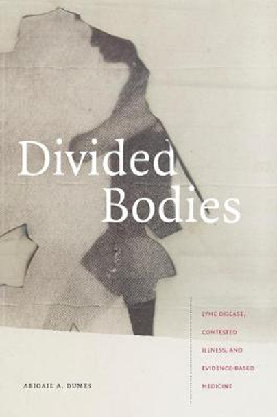 Divided Bodies: Lyme Disease, Contested Illness, and Evidence-Based Medicine by Abigail A. Dumes