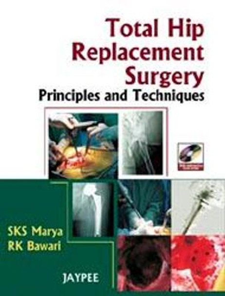 Total Hip Replacement Surgery: Principles and Techniques by S. K. S. Marya