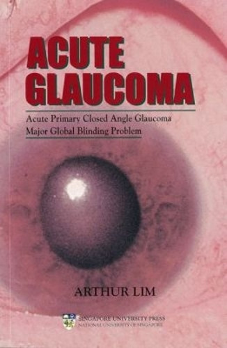 Acute Glaucoma: Acute Primary Closed Angle Glaucoma - a Major Global Blinding Problem by Arthur Lim 9789810459482
