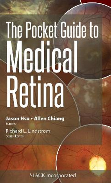 The Pocket Guide to Medical Retina by Jason Hsu