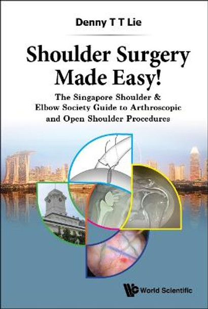 Shoulder Surgery Made Easy!: The Singapore Shoulder & Elbow Society Guide To Arthroscopic And Open Shoulder Procedures by Denny T T Lie