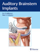 Auditory Brainstem Implants by Eric Wilkinson 9781626238268