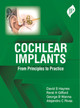 Cochlear Implants: From Principles to Practice by David S Haynes 9781787791190