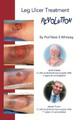 Leg Ulcer Treatment Revolution by Mark S Whiteley 9781908586056