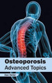 Osteoporosis: Advanced Topics by Dan Heller 9781632423054