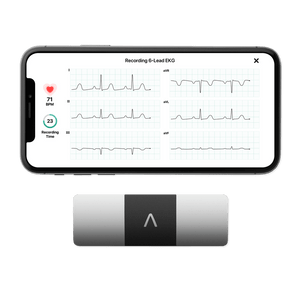 EKG, PERSONAL, KARDIAMOBILE 6L