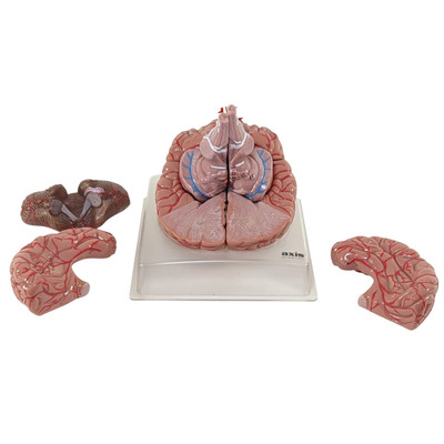 PICTURE OF HUMAN BRAIN WITH ARTERIES