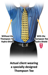 Hyperhidrosis: Is It Making You Sweat Too Much?