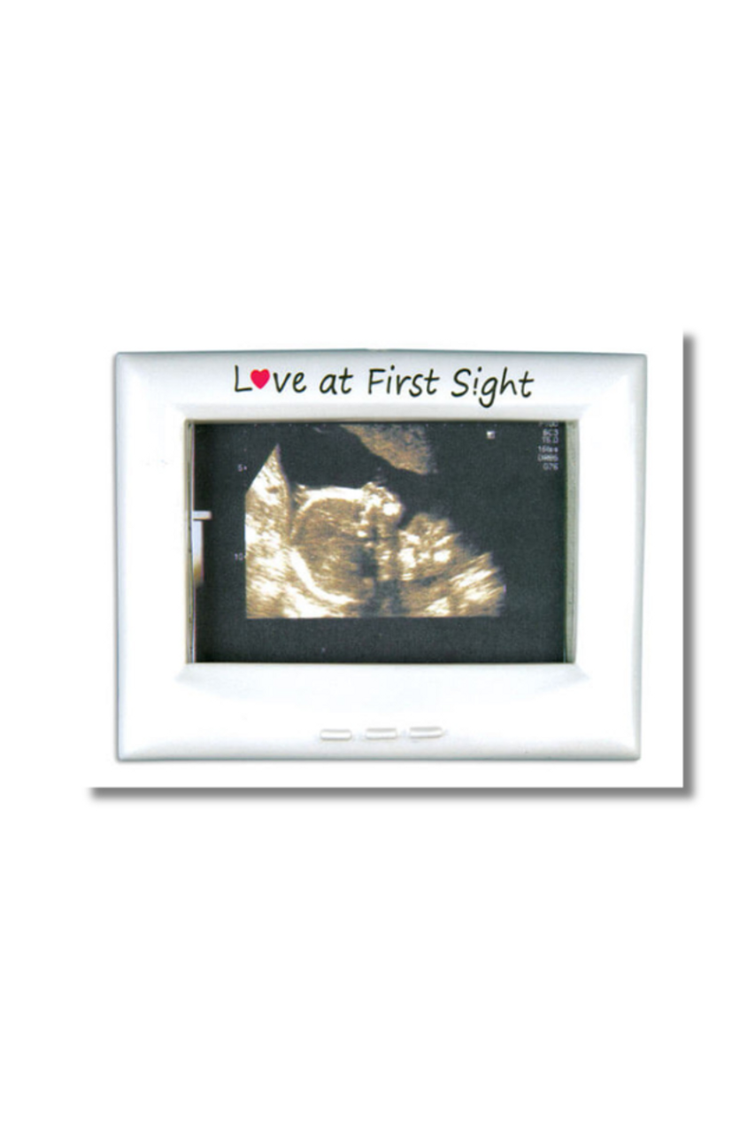  Ultrasound Picture Frame