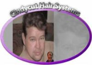 Hair System Prices Hair System Prices