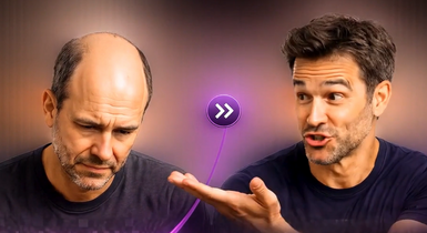 Bald Truth or Confident Glow-Up? You Decide! ?‍♂️✨