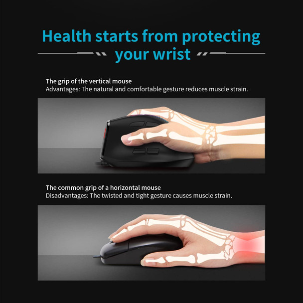 zelotes Wired Vertical Mouse,2021 Ergonomic Design USB LED Optical Mouse with 6 Buttons and 4 Adjustable Sensitivity 800/1200/2400/3200DPI for Computer,Black… (T50Wired)