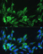 Immunofluorescence analysis of NIH-3T3 cells using LRPAP1 Rabbit polyclonal antibody (STJ24426) at dilution of 1:100 (40x lens). Secondary antibody: Cy3 Goat Anti-Rabbit IgG (H+L) at 1:500 dilution. Blue: DAPI for nuclear staining.