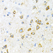 Immunohistochemistry analysis of LRPAP1 in paraffin-embedded mouse brain using LRPAP1 Rabbit polyclonal antibody (STJ24426) at dilution of 1:200 (40x lens). Perform microwave antigen retrieval with 10 mM PBS buffer pH 7. 2 before commencing with immunohistochemistry staining protocol.