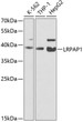 Western blot analysis of various lysates using LRPAP1 Rabbit polyclonal antibody (STJ24426) at 1:200 dilution. Secondary antibody: HRP Goat Anti-Rabbit IgG (H+L) (STJS000856) at 1:10000 dilution. Lysates/proteins: 25 Mu g per lane. Blocking buffer: 3% nonfat dry milk in TBST. Detection: ECL Basic Kit. Exposure time: 90s.