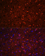Immunofluorescence analysis of paraffin-embedded mouse brain using Tau Rabbit polyclonal antibody (STJ24499) at dilution of 1:100 (40x lens). Secondary antibody: Cy3 Goat Anti-Rabbit IgG (H+L) at 1:500 dilution. Blue: DAPI for nuclear staining.