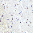 Immunohistochemistry analysis of Tau in paraffin-embedded rat brain using Tau Rabbit polyclonal antibody (STJ24499) at dilution of 1:100 (40x lens). Perform microwave antigen retrieval with 10 mM PBS buffer pH 7. 2 before commencing with immunohistochemistry staining protocol.